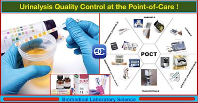 Urinalysis quality control at the point